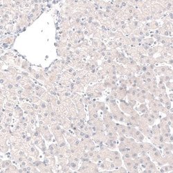 GRHL2 Antibody (CL3760), Novus Biologicals:Antibodies:Primary Antibodies